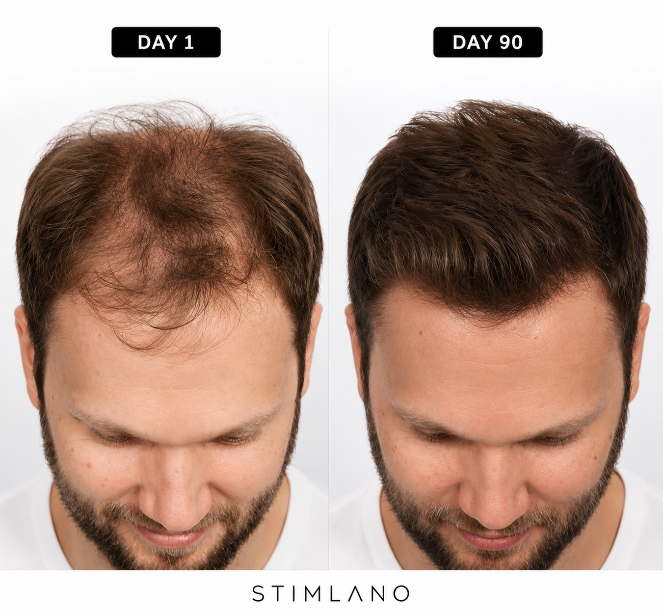 Red Light Therapy Cap for Hair Regrowth Treatment