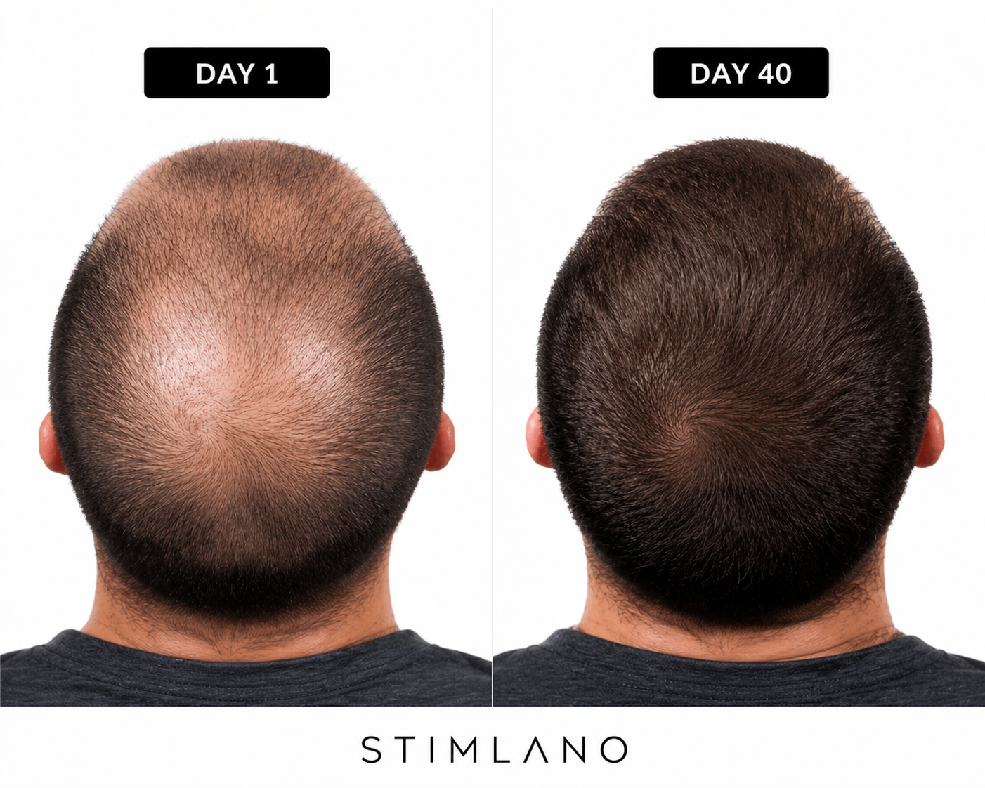 Red Light Therapy Cap for Hair Regrowth Treatment