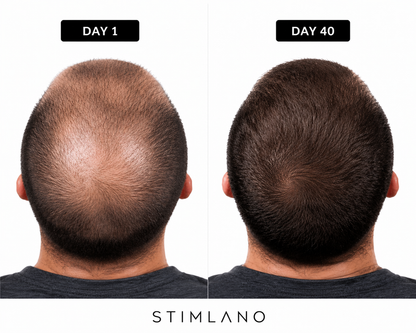 Red Light Therapy Cap for Hair Regrowth Treatment