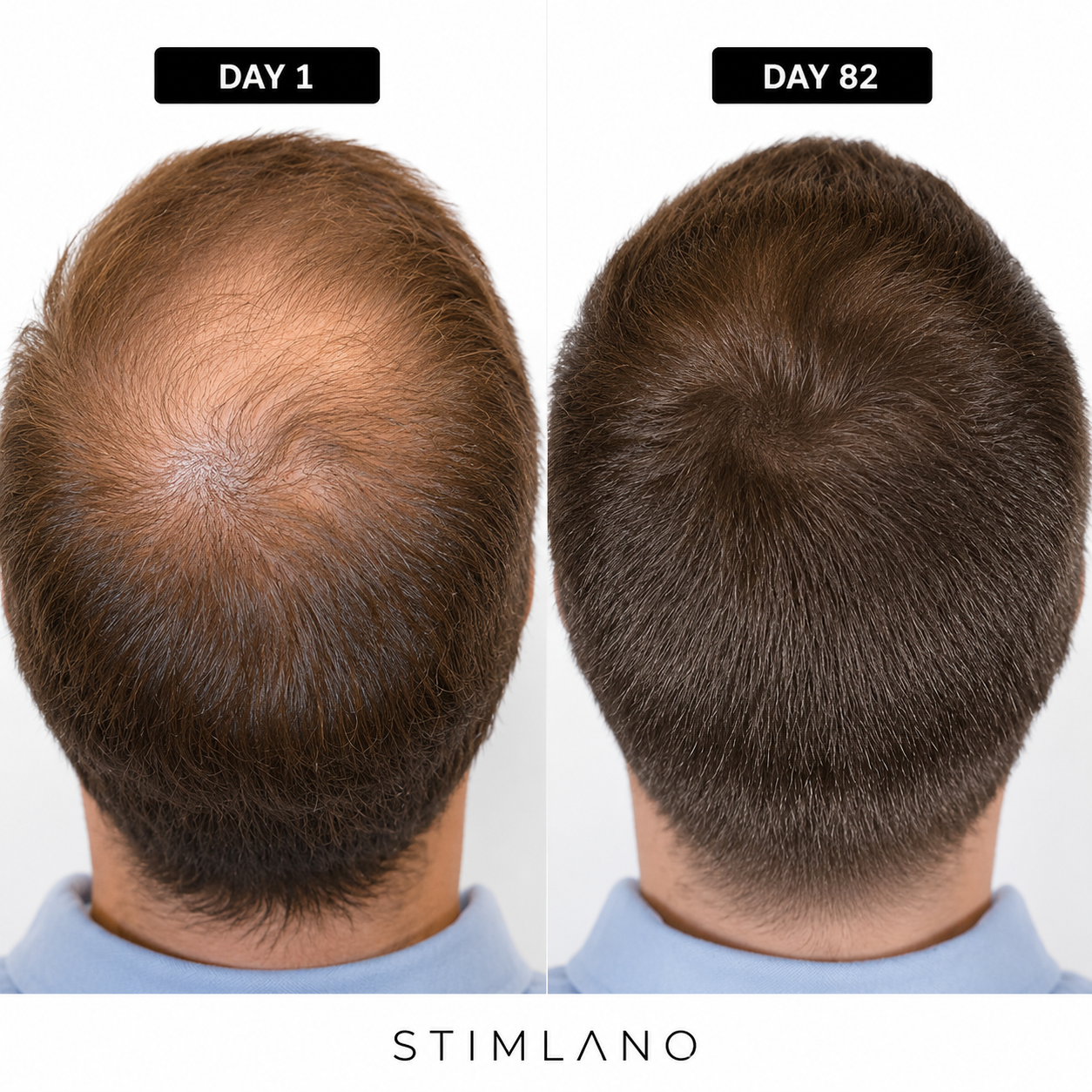 Red Light Therapy Cap for Hair Regrowth Treatment
